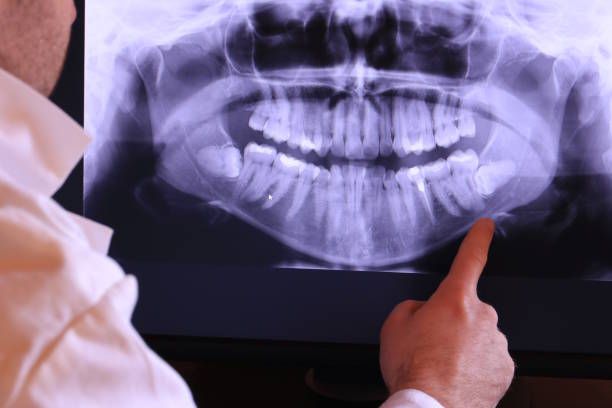 Best Walk-In Emergency Dentist in Thomasville, GA