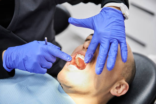 Best Emergency Tooth Extraction in Thomasville, GA