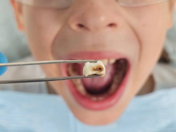Best Same-Day Emergency Dentist in Thomasville, GA