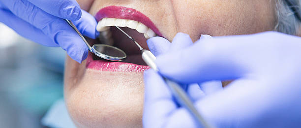 Best Emergency Root Canal Treatment in Thomasville, GA
